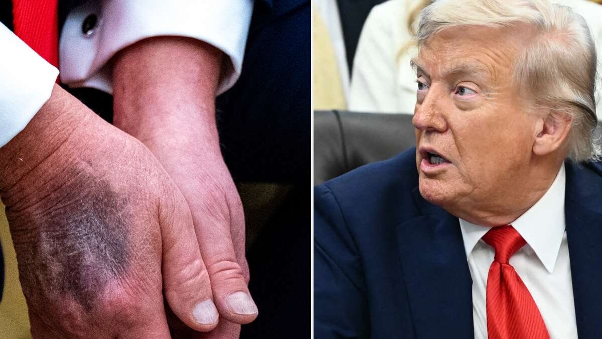 États-Unis : Pourquoi les rumeurs sur la santé de Donald Trump enflent